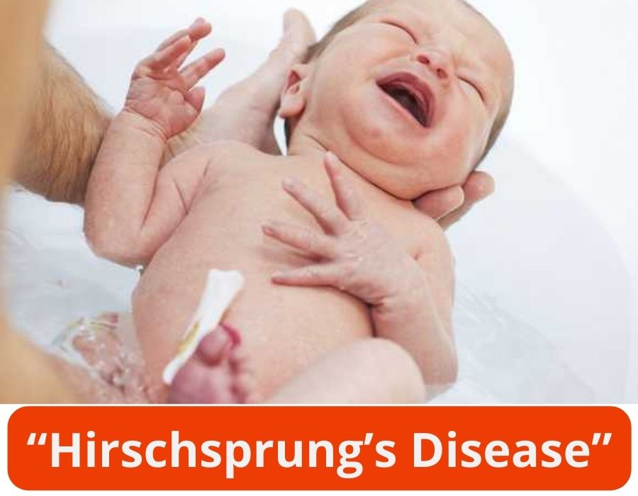 hirschsprung's disease in childrens-Dr. Apoorva kulkarni pediatrician in thane-bandra-chembur