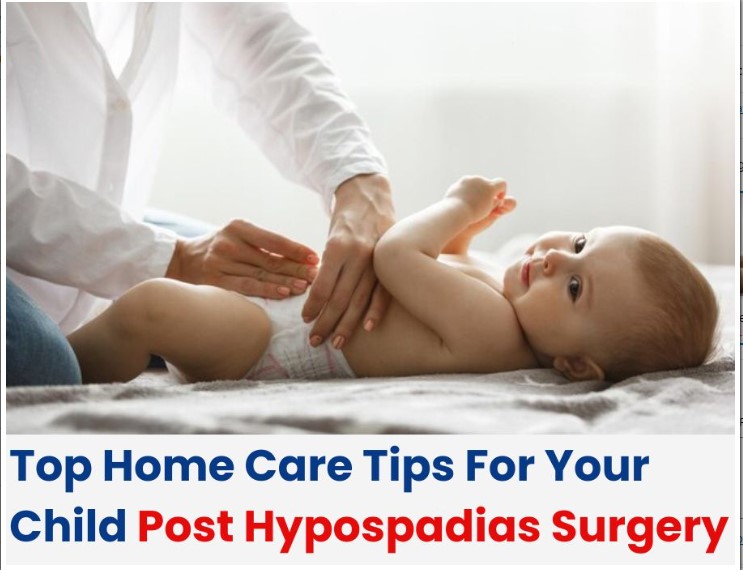 Top Home Care Tips For Your Child Post Hypospadias Surgery