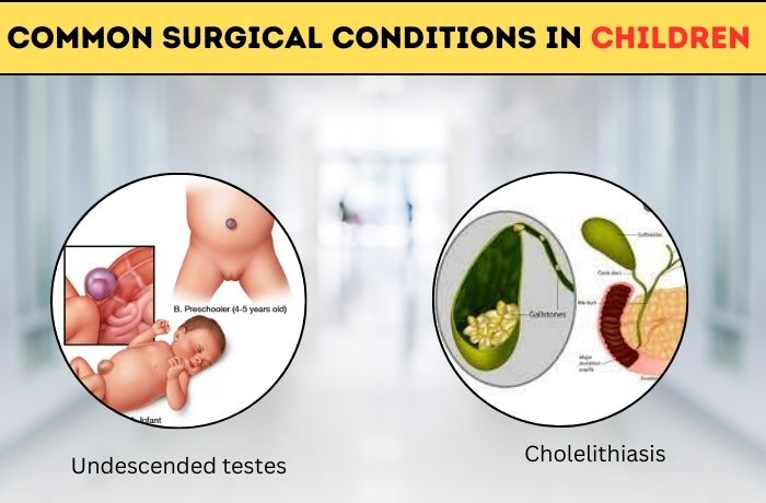 Common Surgical Conditions In Children