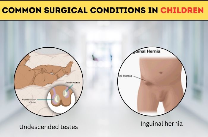 Common Surgical Conditions In Children And Important Things To Remember Regarding Them