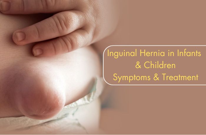 Inguinal Hernia in Infants & Children: Symptoms & Treatment