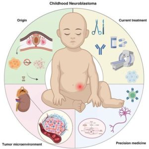 neuroblastoma
