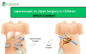 Laparoscopic vs. Open Surgery in Children: Which is Better?