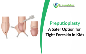 Preputioplasty: A Safe Alternative to Circumcision for Tight Foreskin in Children