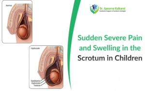 Sudden Severe Pain and Swelling in the Scrotum in Children - What Every Parent Must Know