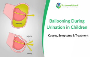Ballooning During Urination in Children Causes, Symptoms & Treatment